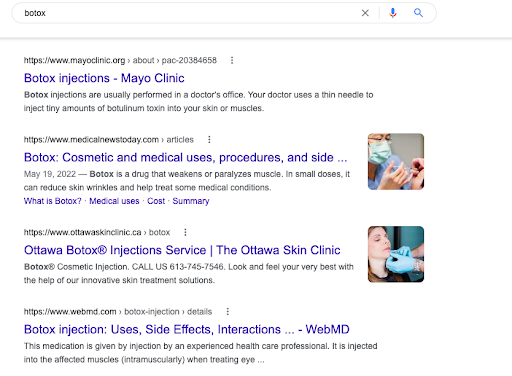 Screenshot example of a informational intent Google search results page. This page shows search results for the keyword "Botox."